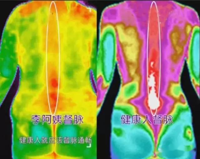 紅外熱成像可以看病？了解一下醫(yī)療診斷應(yīng)用